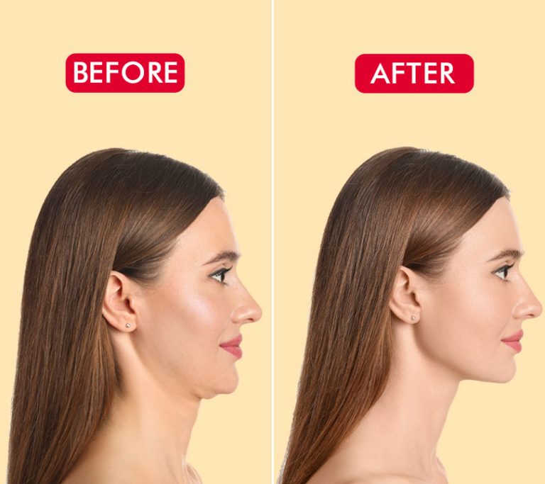 10 Easy Methods to Tighten Your Skin Naturally!