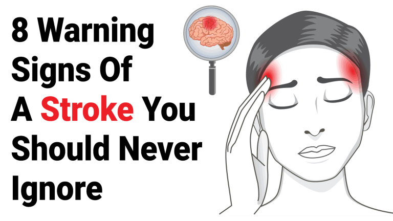 One Month Before Stroke Your Body Will Send You These Warning Signs