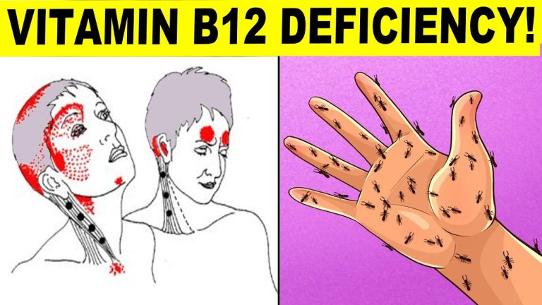 Never Ignore These Warning Signs of Vitamin B12 Deficiency