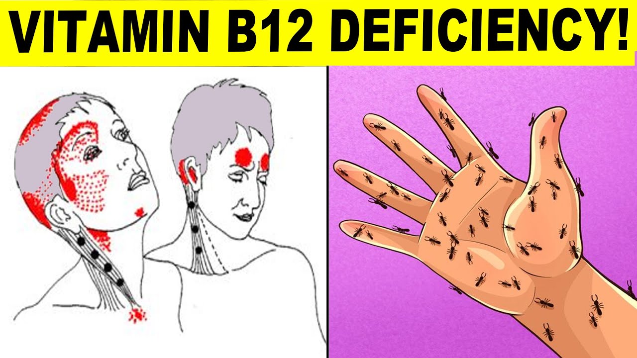 deficiency of vitamin b12 and d3