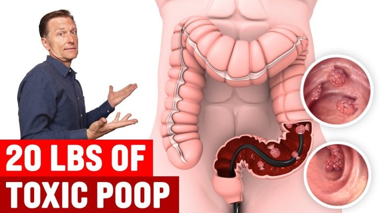 Cleanse Your Colon and Lose 30 Pounds Within a Month!