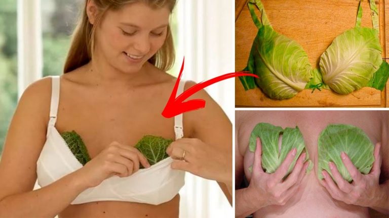 Wrap Your Breasts In Cabbage Leaves and Wait for 1 Hour