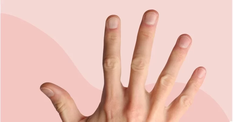 Do Not Ignore These Nail Conditions Linked To Serious Diseases