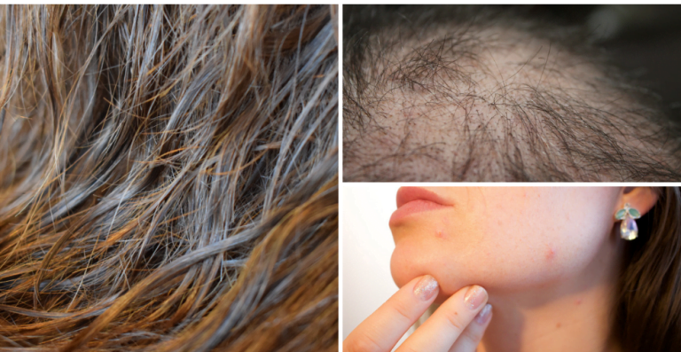 The Damage Sleeping With Wet Hair Does To Your Body !