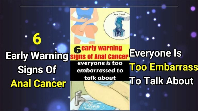 6 Early-Warning Signs Of Anal Cancer Everyone Is Too Embarrassed To Talk About!