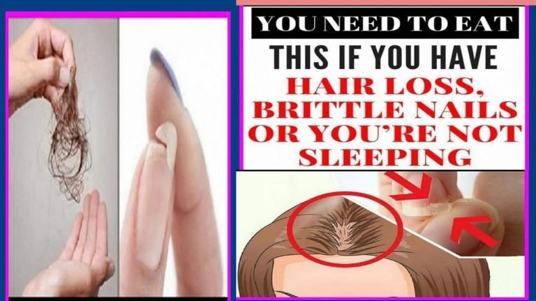 You Need To Eat This If You Have Hair Loss, Brittle Nails Or You’re Not Sleeping Well