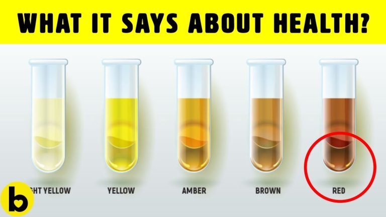 Here’s What The Color of Your Urine Says About Your Health