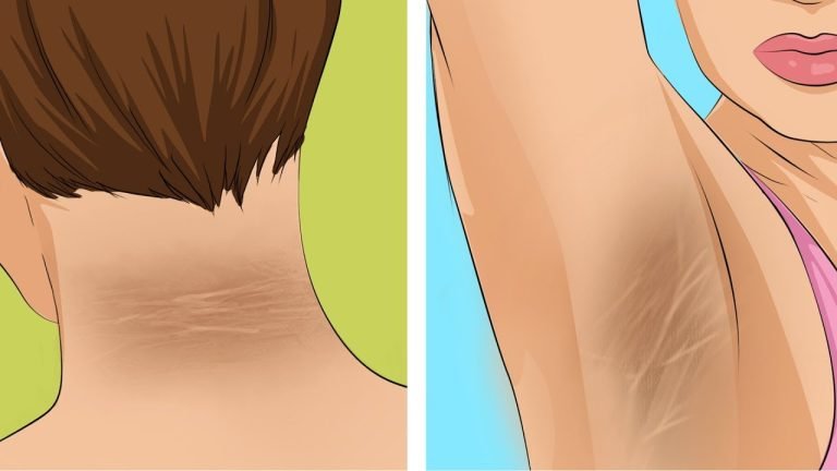 One Month Before a Heart Attack, Your Body Will Warn You